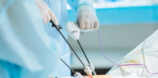 Beneficiile laparoscopiei in tratarea afectiunilor abdomino