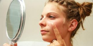 Scapa rapid de acnee. Doua tratamente naturiste impotriva acneei